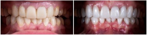 Dentist-Cluj-Napoca