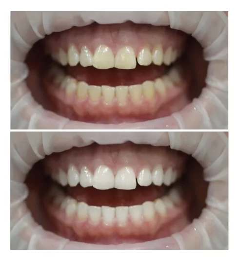 Dentist-Cluj-Napoca