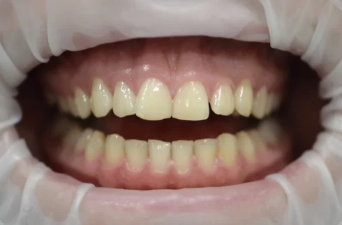 Dentist-Cluj-Napoca
