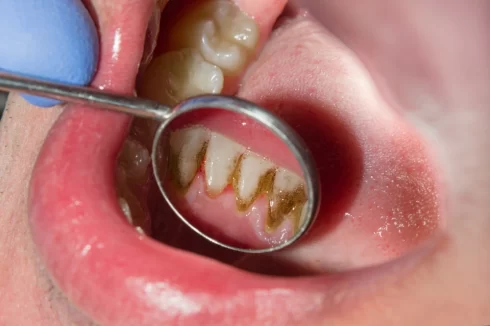 Dentist-Cluj-Napoca