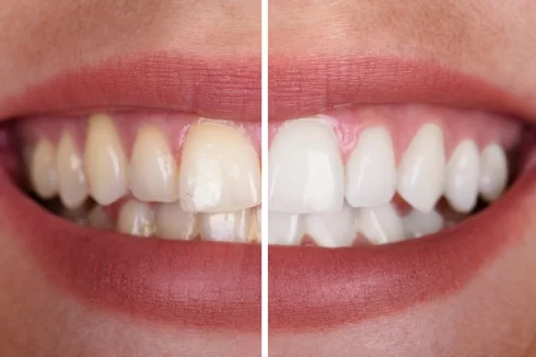 Dentist-Cluj-Napoca
